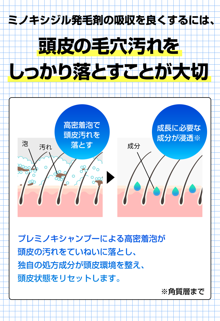 ミノキシジル発毛剤の吸収を良くするには、頭皮の毛穴汚れをしっかり落とすことが大切